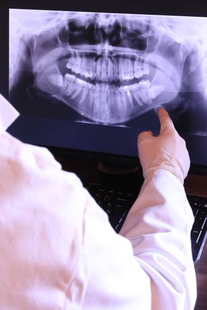 Best Dental Abscess Treatment in Midland, WA