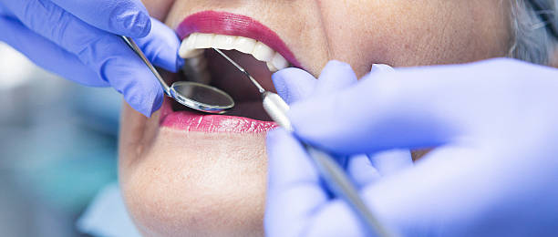 Best Emergency Cosmetic Dentistry (e.g., broken veneers) in Midland, WA